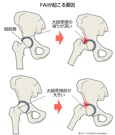 FAIが起こる要因